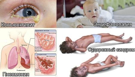Хламидиоз у детей: пути заражения и возможные симптомы, методы лечения и профилактики, вероятные осложнения
