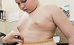 Степени ожирения у детей: этиология и классификация заболевания, симптомы отклонений веса, расчет ИМТ и характеристика каждой стадии болезни