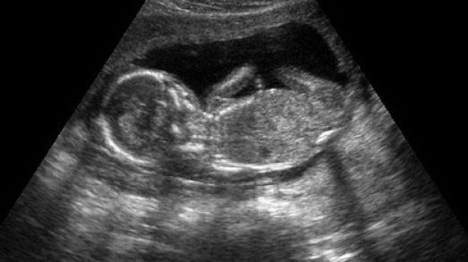 15 неделя беременности: внешний вид и параметры плода, первые шевеления и ощущения мамы