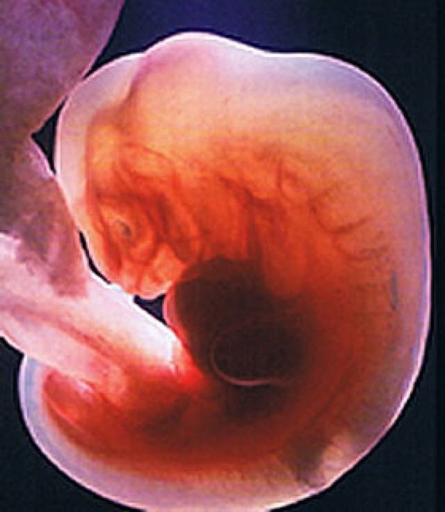 4 неделя беременности: что происходит в организме мамы и малыша, признаки и ощущения