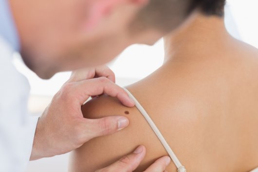 Актинический кератоз кожи: причины образования, сопутствующие симптомы, методы лечения и профилактика