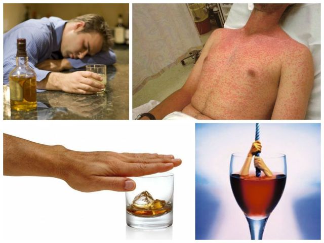 Аллергия на алкоголь: как проявляется, первая помощь и принципы лечения