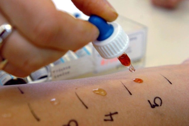 Аллергия после прививки: причины возникновения, клинические проявления, методы терапии и профилактика