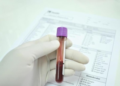 Анализ крови на эозинофилы ребенка: причины назначения, рекомендации по подготовке, расшифровка результатов