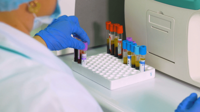 Анализ крови на онкомаркер СА 72-4: показания к исследованию, показатели нормы, причины повышения