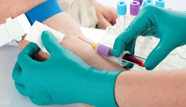 Анализ крови на свертываемость: методы исследования, правила подготовки, нормы и отклонения