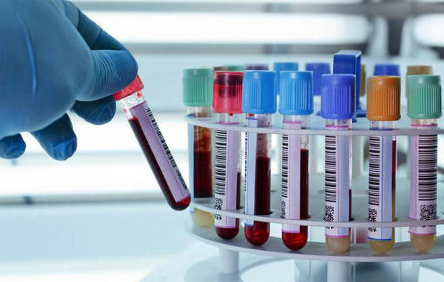 Анализ крови на туберкулез: разновидности диагностики, показания и противопоказания, особенности проведения