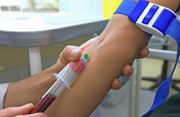 Анализ крови по методу ифа: расшифровка, назначение, необходимость определения антител.
