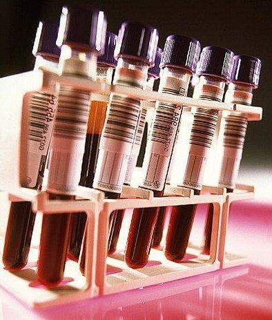 Анализ на гормоны щитовидной железы: как сдавать, расшифровка проб крови и нормы показателей