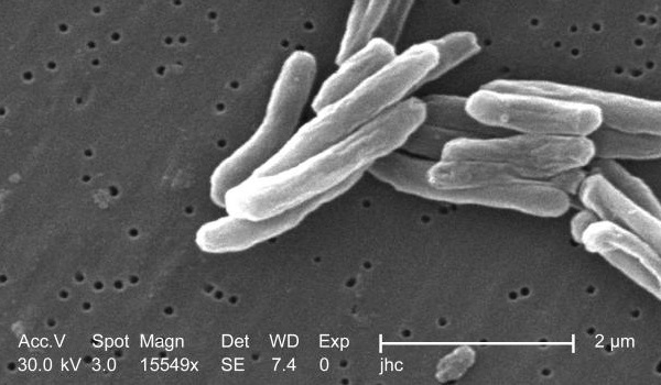 Анализ на Helicobacter Pylori (Хеликобактер Пилори): какие тесты и анализы крови позволяют выявить бактерии?