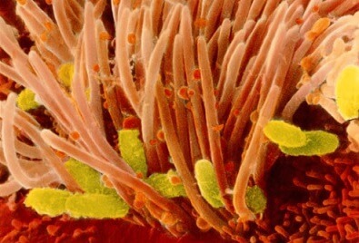 Анализы на коклюш (Bordetella pertussis): о чем могут рассказать антитела