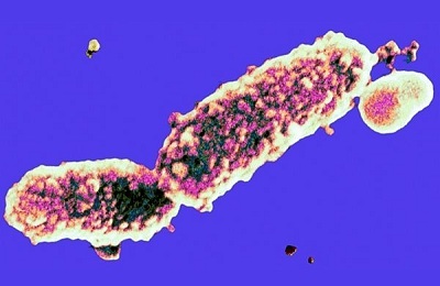 Анализы на коклюш (Bordetella pertussis): о чем могут рассказать антитела