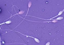 Астенозооспермия: причины и степени патологии, методы терапии, вероятность зачатия