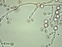 Бактериологический посев при молочнице, микроскопия урогенитального мазка