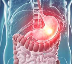Безоар желудка у человека: виды заболевания и причины появления, характерные симптомы и принципы лечения