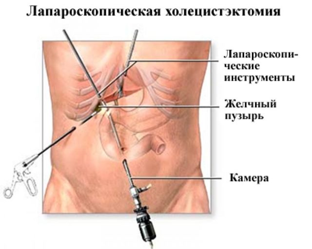 Боль в правом боку на уровне талии спереди и со спины у женщин и мужчин