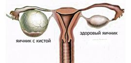 Болезненное уплотнение в животе у женщин:  возможные причины и методы диагностики 