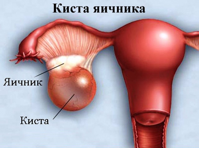 Болезненное уплотнение в животе у женщин:  возможные причины и методы диагностики 
