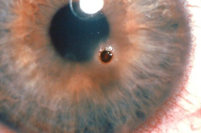 Болят глаза: причины дискомфорта, методы обследования и терапии, меры профилактики