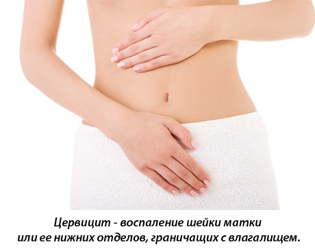 Цервицит (воспаление шейки матки): причины появления болезни и когда следует отказаться от половой жизни?