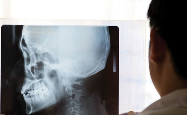 Что показывает и как делают рентген головы при сотрясении у ребенка и взрослого