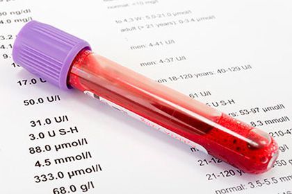 Что такое анализ крови на онкомаркеры: что показывает маркер СА 15-3?