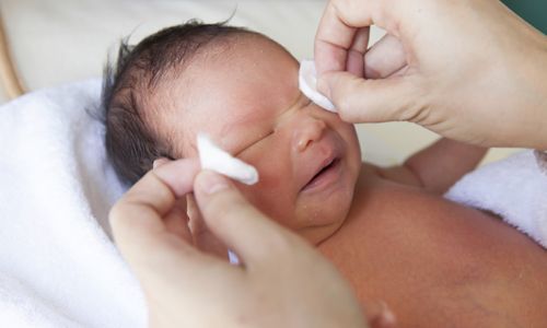 Дакриоцистит у новорожденных: причины заболевания, типичные симптомы, принципы лечения и меры предосторожности