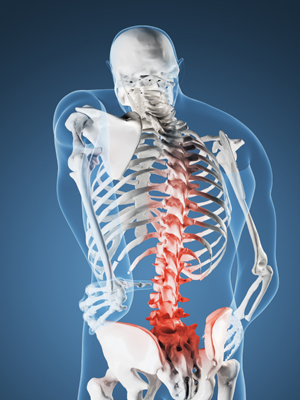 Деформирующий остеит костей или болезнь Педжета: причины развития, основные симптомы, диагностика и принципы лечения