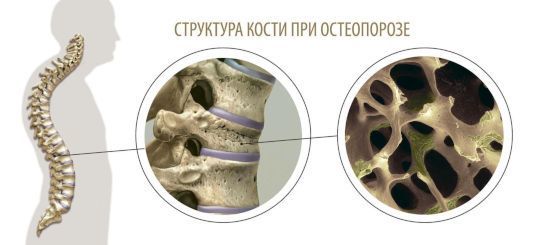 Денситометрия костей: суть процедуры, правила подготовки, особенности проведения диагностики
