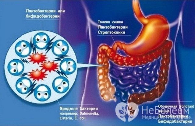 Дисбактериоз кишечника: причины возникновения, характерные симптомы и методы лечения