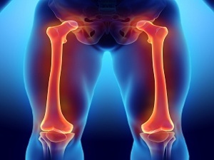 Эностоз бедренной кости: описание патологии и современные способы терапии заболевания