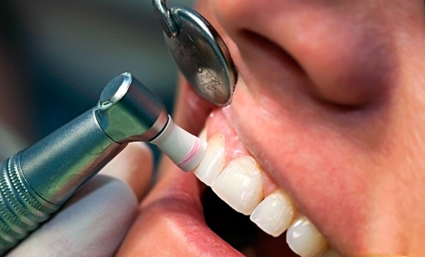 Эрозия зубной эмали — причины кариозного и некариозного поражения