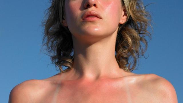 Фотодерматит на лице и теле: причины, симптомы аллергии