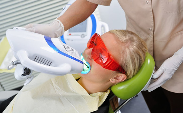 Фотоотбеливание зубов: что это, подготовка к процедуре