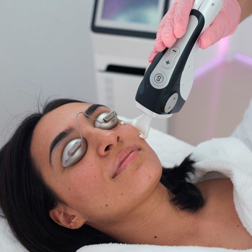 Фракционное лазерное омоложение кожи вокруг глаз: особенности проведения процедуры