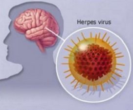 Герпес 7 типа: симптомы и лечение, диагностика и профилактика вируса