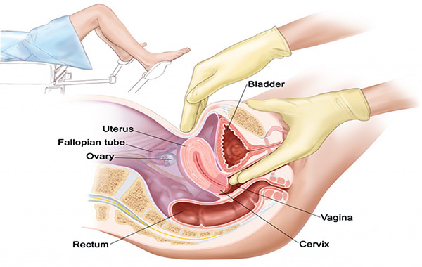 Гинекологический массаж матки: назначение для процедуры, техника выполнения, воздействие на организм