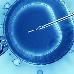 ИКСИ-оплодотворение: что это такое, основные различия репродуктивных технологий, показания и этапы проведения