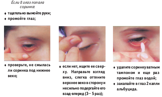 Инородное тело глаза: что делать, если что-то попало в глаз под верхнее веко, как извлечь