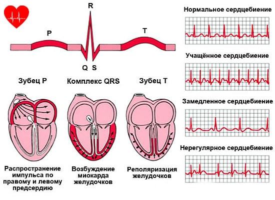 Ишемическая болезнь сердца: симптомы, дифференциальная диагностика, лечение