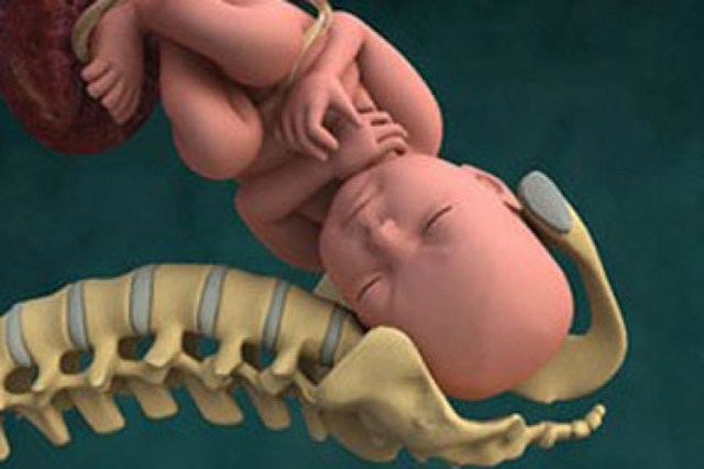 Искусственные роды: показания к процедуре и прогнозы для беременной - Детский доктор