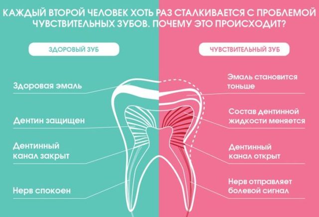 Как бороться с повышенной чувствительностью зубов: причины повышенной чувствительности зубов и методы их устранения