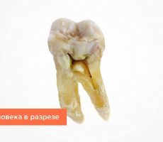 Как бороться с повышенной чувствительностью зубов: причины повышенной чувствительности зубов и методы их устранения