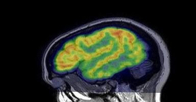 Как подтвердить диагноз эпилепсия