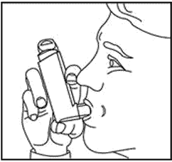 Как правильно принимать Беклометазон при бронхиальной астме: инструкция по применению препарата