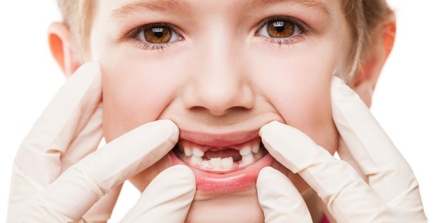 Как правильно удалять молочные зубы у детей, когда лучше?