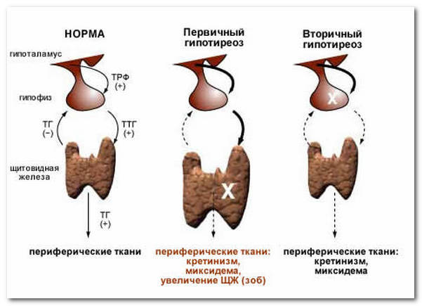 Как расшифровать анализ крови на гормоны щитовидной железы: о чем говорит понижение т4 при повышенном ттг