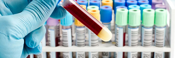 Как расшифровать данные анализа крови и иммунограммы