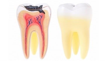 Как убить зубной нерв в домашних условиях, почему болит зубной нерв: методы обезболивания и рекомендации