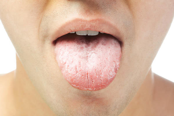 Какие причины появления язв во рту: рекомендации к лечению в домашних условиях,